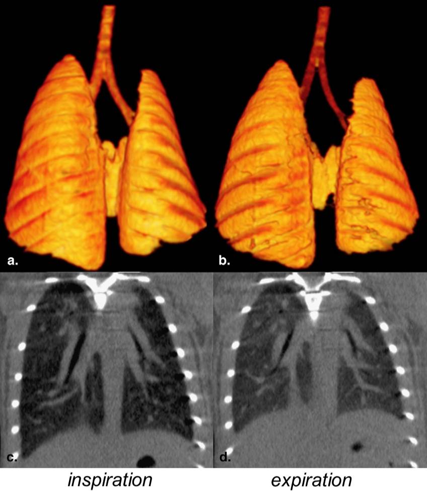 lung dynamics