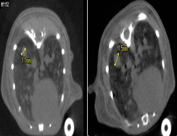 Lung Tumor Disease