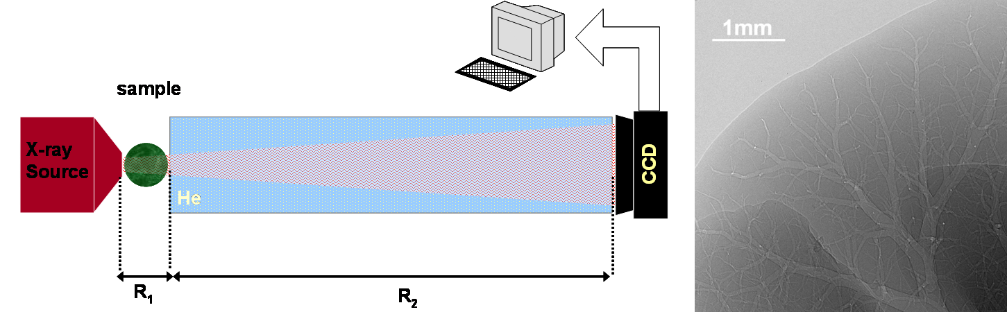 X-ray Phase Contrast Imaging